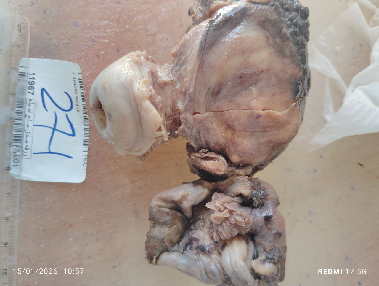 صورة التقرير