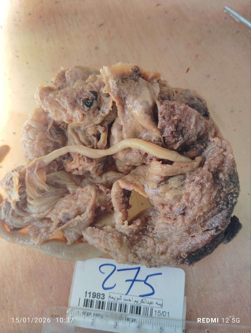 صورة التقرير