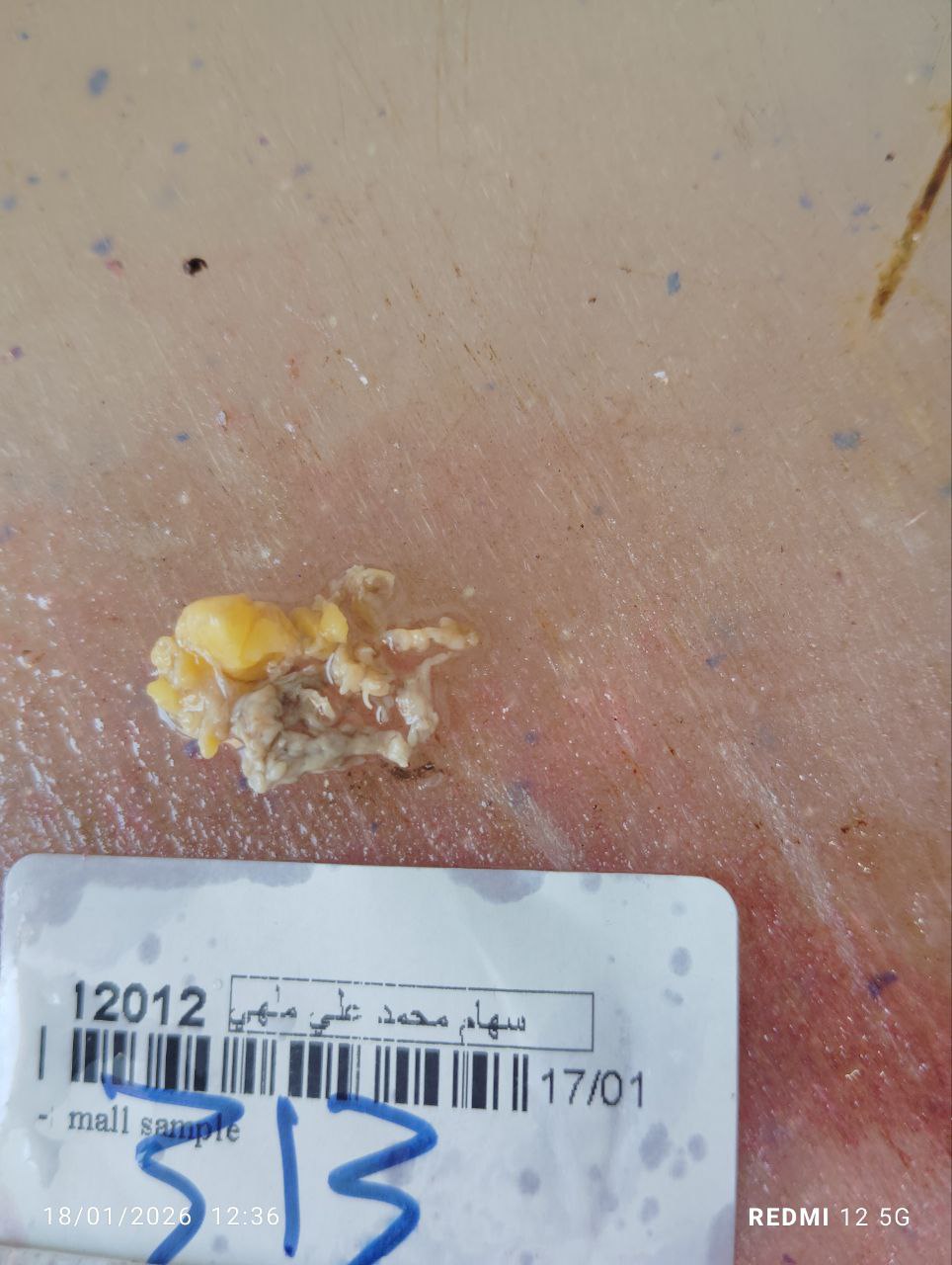 صورة التقرير