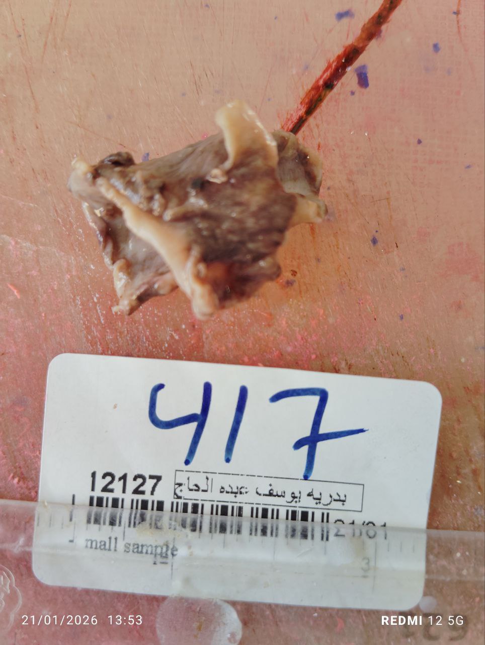 صورة التقرير