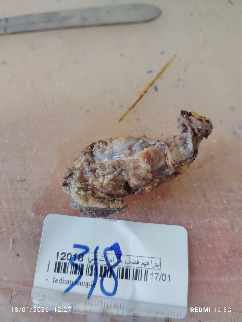 صورة التقرير