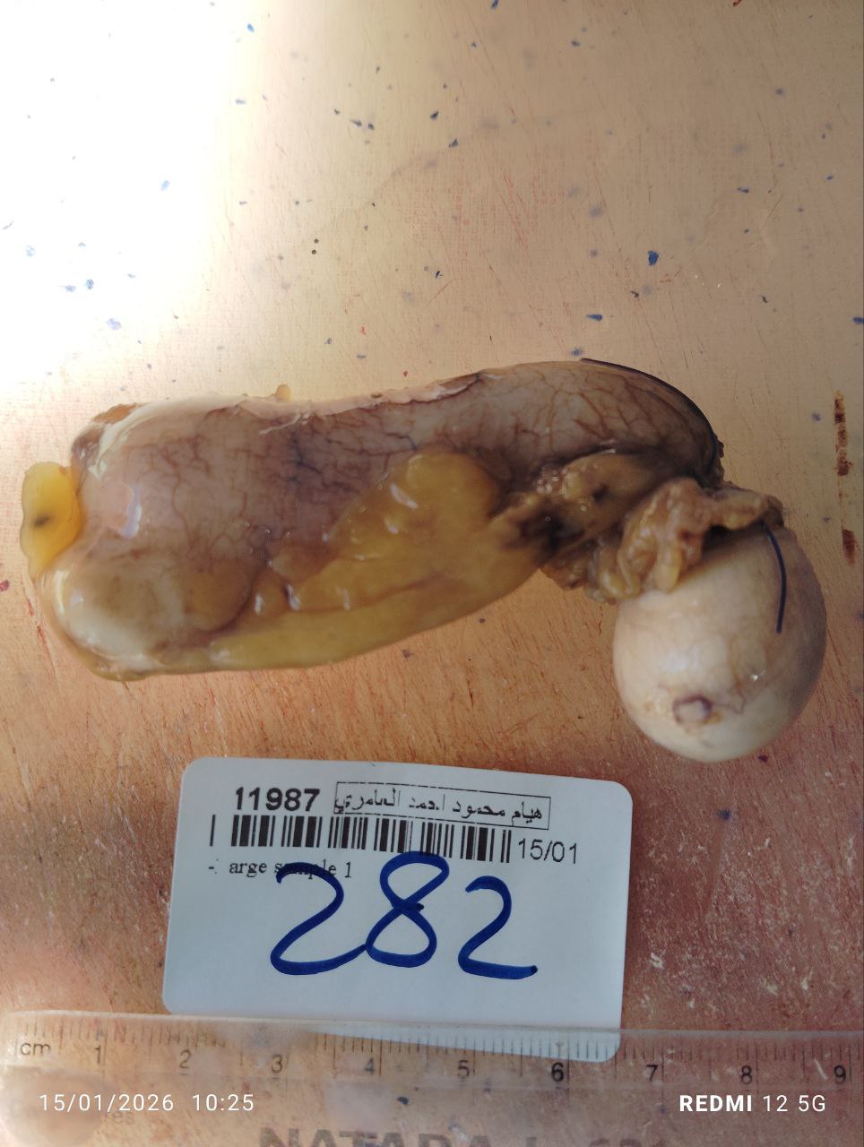 صورة التقرير