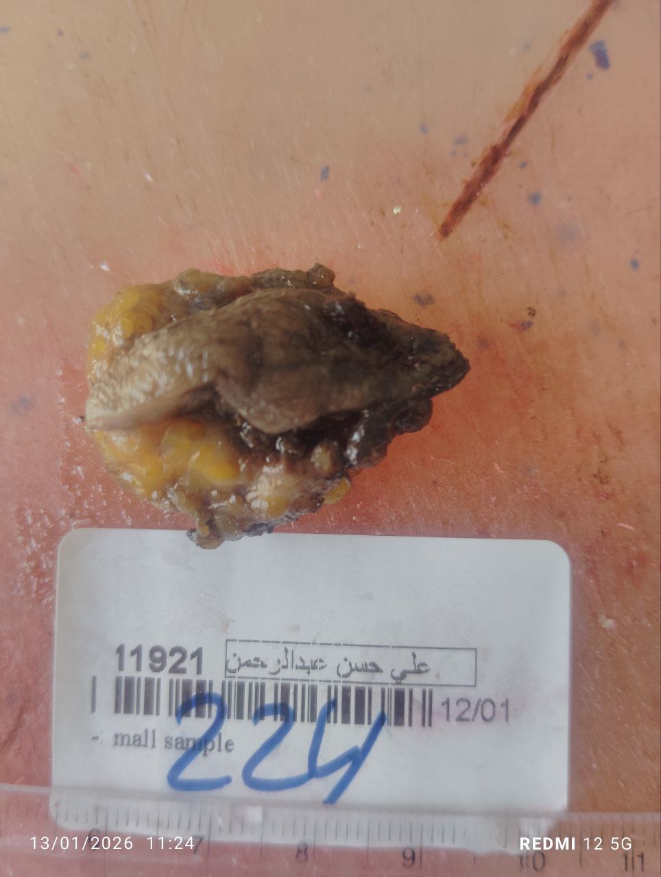 صورة التقرير