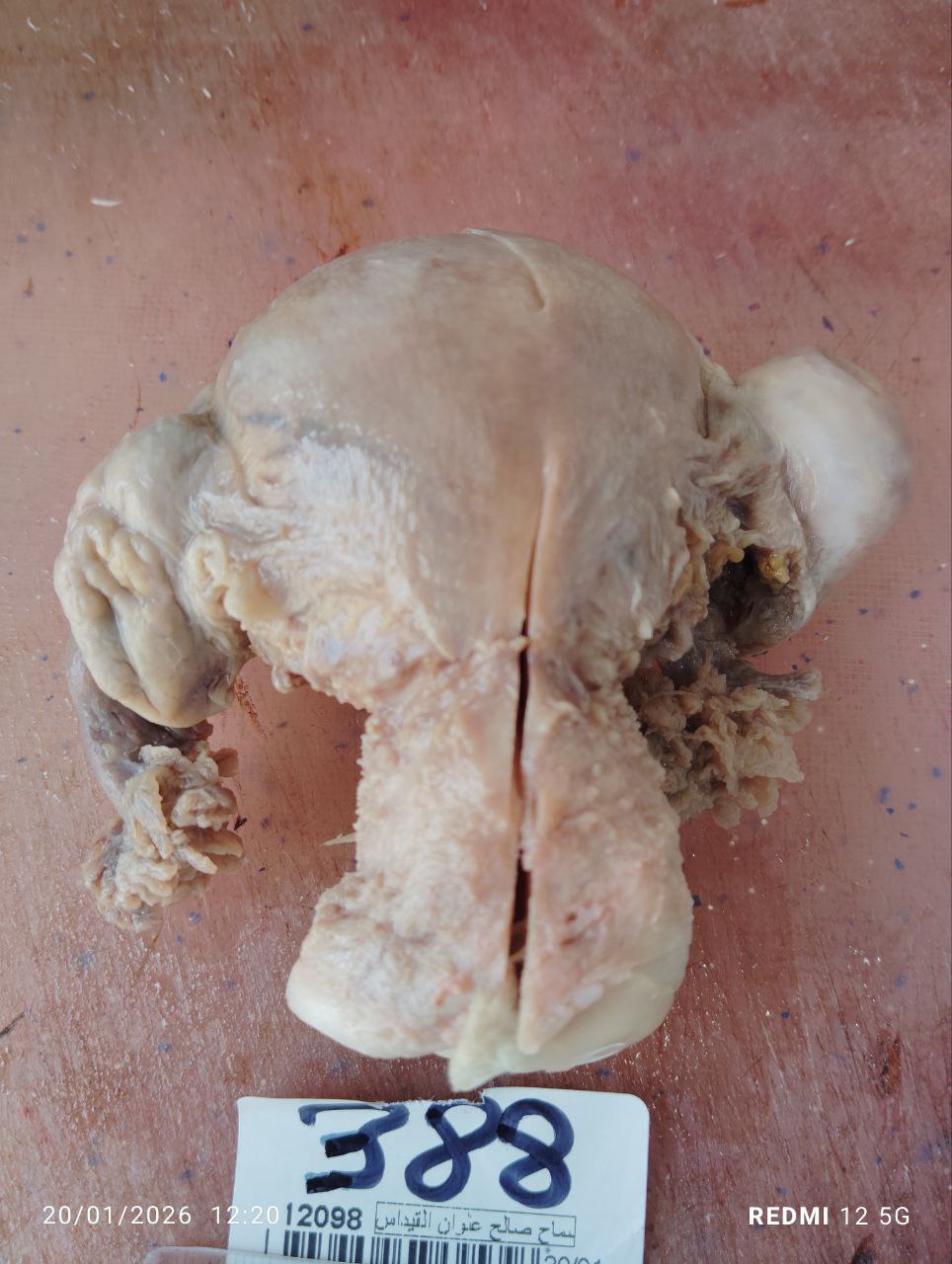 صورة التقرير