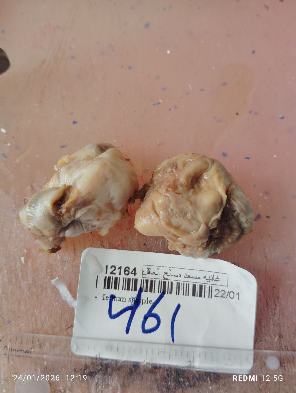 صورة التقرير