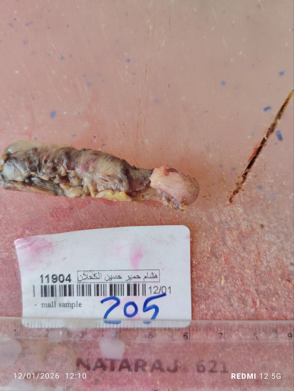 صورة التقرير