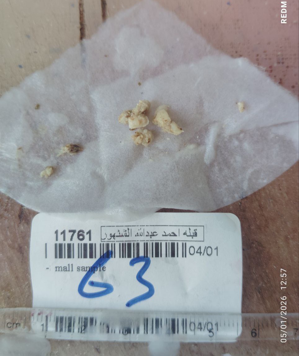 صورة التقرير