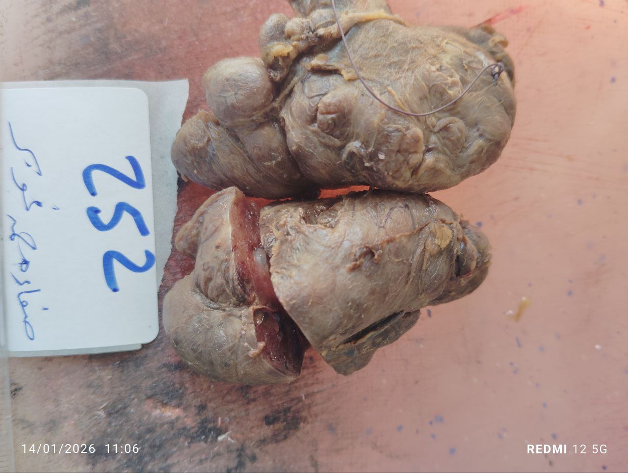 صورة التقرير