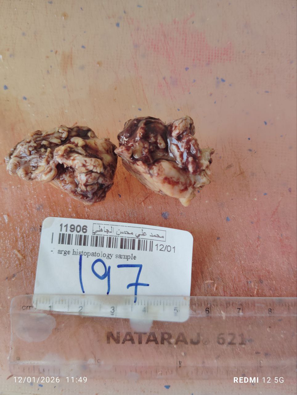 صورة التقرير