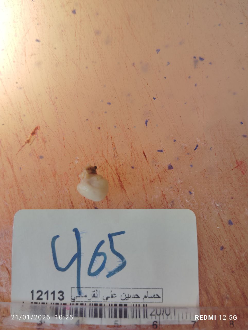 صورة التقرير