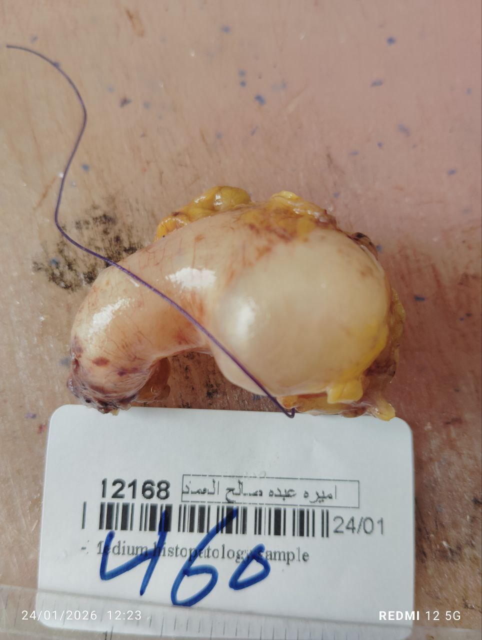 صورة التقرير